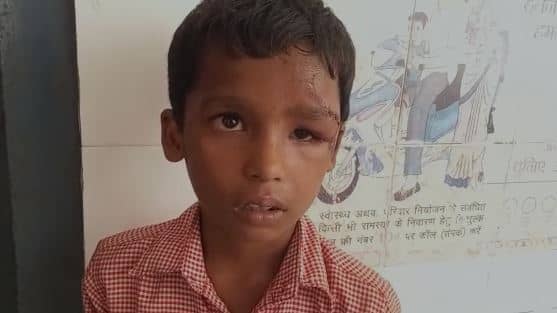 नामांकन कराने गए छात्र की शिक्षक ने बेरहमी से की पिटाई, जन्म प्रमाण-पत्र भी छीना