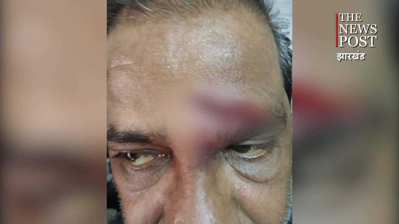 BREAKING: कतरास के  रानी बाजार में डाका ,घर मालिक को घायल कर लूटपाट 