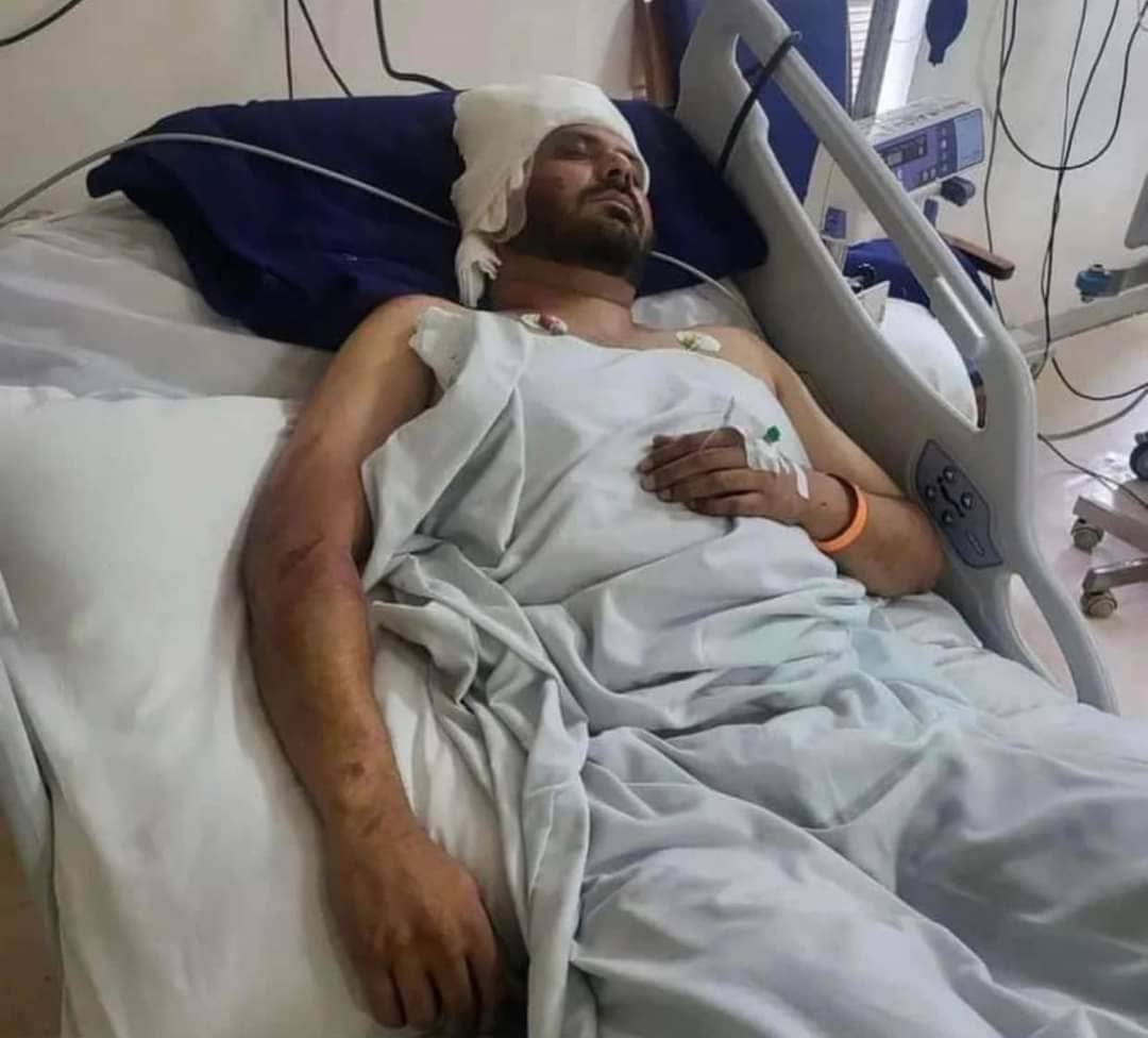 Yo Yo Honey Singh के साथ 14 गानों में काम कर चुके सिंगर अल्फाज पर जानलेवा हमला, हालत नाजुक