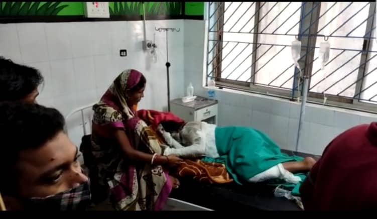 Breaking : दुमका में एक बार फिर पेट्रोल कांड, सनकी आशिक ने युवती पर पेट्रोल छिड़क लगाया आग,  अस्पताल में  भर्ती