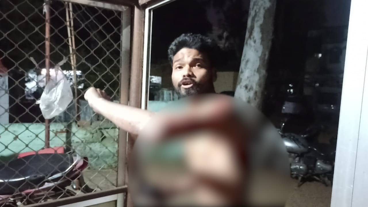 दुमका : दोस्त के भाई ने कर दिया चाकू से हमला, बाल-बाल बची जान