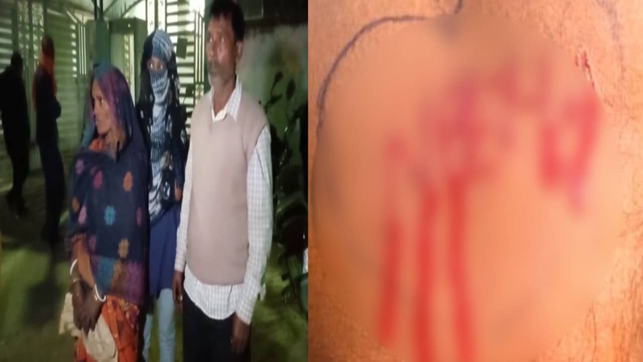 नाबालिक के प्रेम में युवक ने की हद पार, जानिए एक सनकी प्रेमी की ब्लेड वाली लव स्टोरी