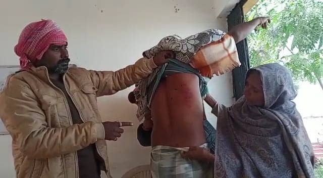 शर्मनाक ! झारखंड में दलित युवक को जबरन प्रतिबंधित मांस खिलाने का आरोप, मना करने पर आरोपियों ने जमकर की पिटाई, टूटा हाथ