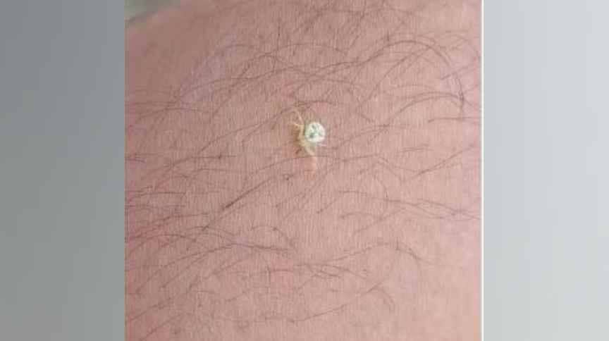 जमशेदपुर में मौजूद सबसे बड़े वन क्षेत्र दलमा के जंगलों में मिली मानवीय शक्ल की मकड़ी, लोगों ने बताया दूसरे ग्रह का