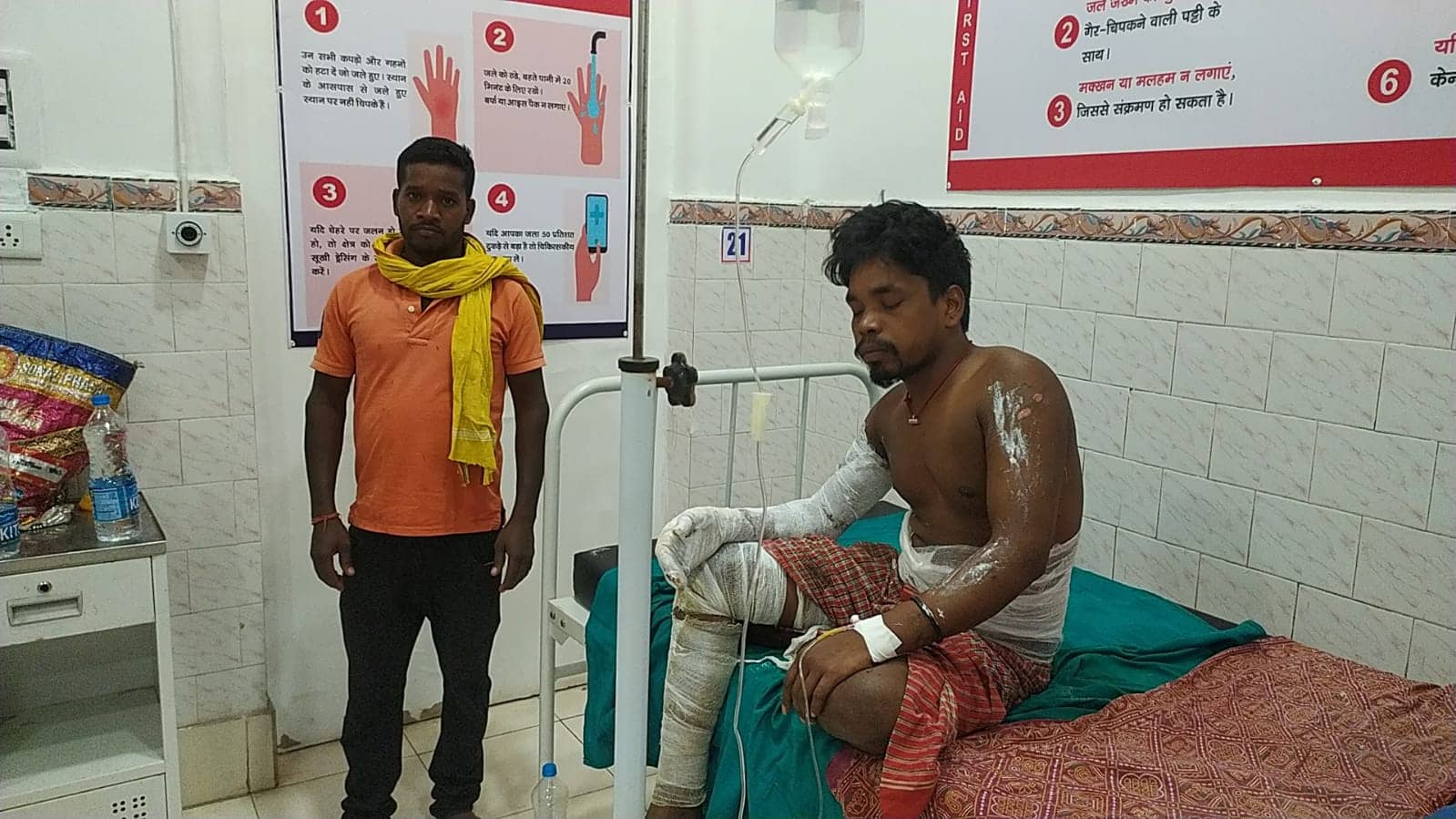 दुमका के मिष्ठान दुकान के एलपीजी सिलेंडर में लगी आग,  गर्म दूध से भरे बर्तन में गिर कर जला कारीगर