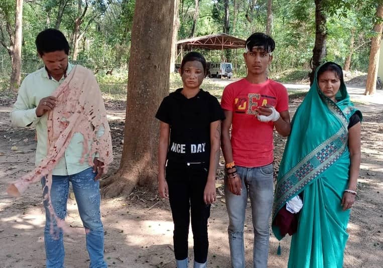 तेजाब कांड के पीड़ित ने एसपी से लगायी न्याय की गुहार, जान से मारने की मिल रही है धमकी