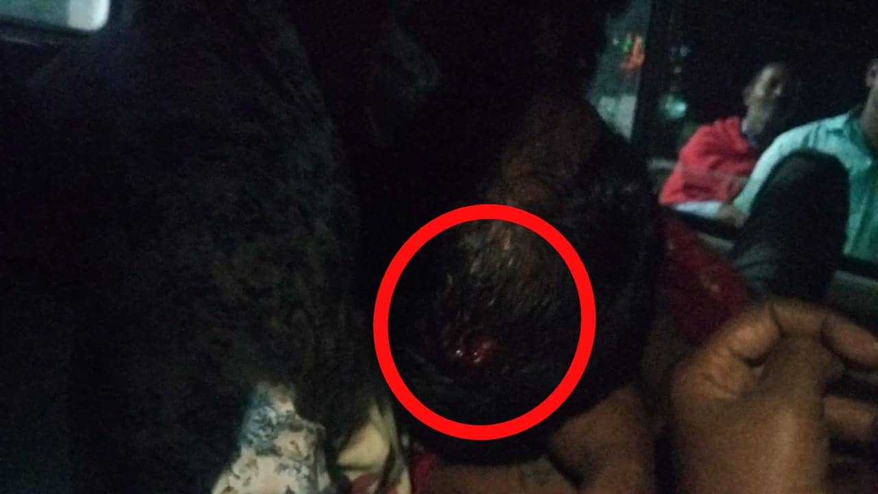 अवैध बालू उठाव के वर्चस्व को लेकर चली गोली, दो घायल