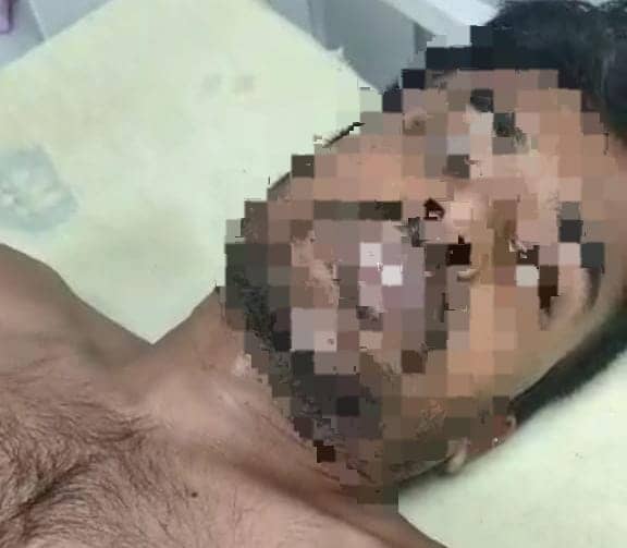 सनकी प्रेमिका की करतूत! गुस्से में काटा प्रेमी का प्राइवेट पार्ट, जानिए फिर क्या हुआ