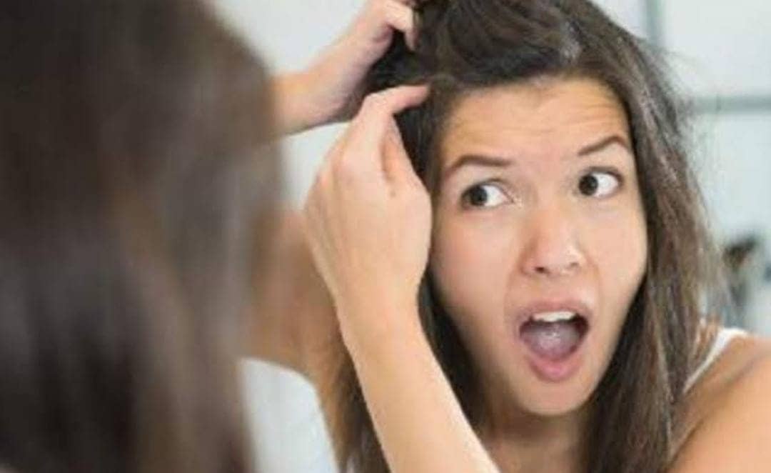 Tips for healthy hair:यदि आपके बाल भी 40 उम्र से पहले हो गये है सफेद, तो करें ये तीन उपाय