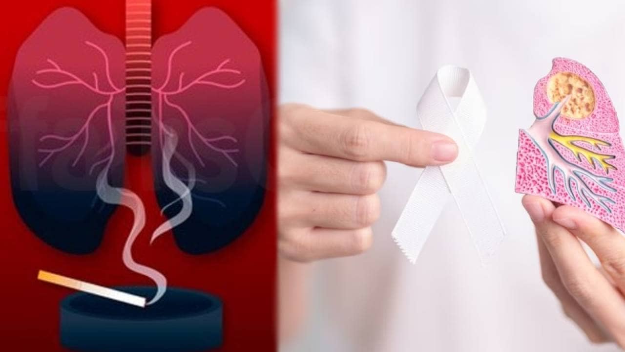 World Lung Cancer Day: भारत में लंग कैंसर से 72 हजार से ज्यादा लोग प्रभावित, 50% नॉन स्मोकर्स, जानिए क्या हैं इसके लक्षण