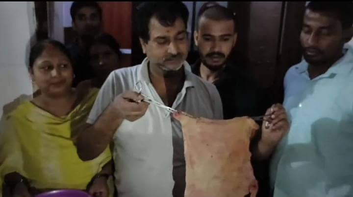 डॉक्टर ने पार की लापरवाही की हद! प्रसव ऑपरेशन के दौरान महिला के पेट में छोड़ा तौलिया, दर्द होने पर हुआ खुलासा, पढ़ें फिर क्या हुआ