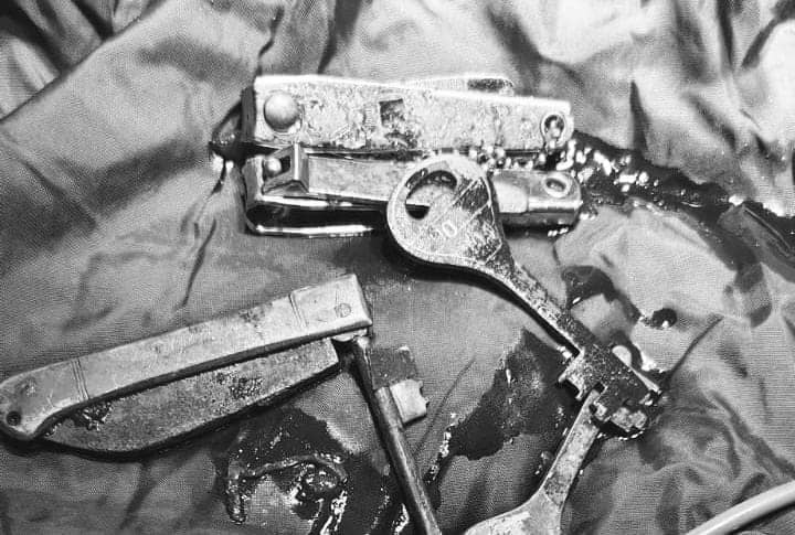 Bihar: फोन देखने में मशगूल युवक ने निगल ली नेल कटर, चाबी और चाकू, ख़ुलासे के बाद परिवार वालों के उड़े होश