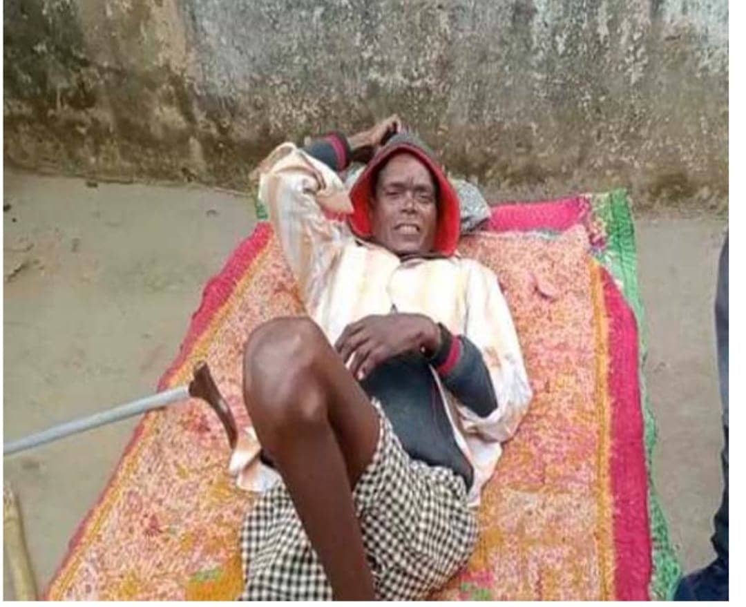 कोविशील्ड के  एक डोज ने खड़ा कर दिया चलने में असमर्थ दुलारचंद मुंडा को, स्वास्थ्य विभाग ने  कहा ये शोध का विषय