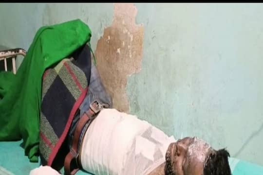 गिरिडीह में सरिया फैक्ट्री में ब्लास्ट, तेल की टंकी फटने से तीन मजदूर गंभीर रुप से जख्मी