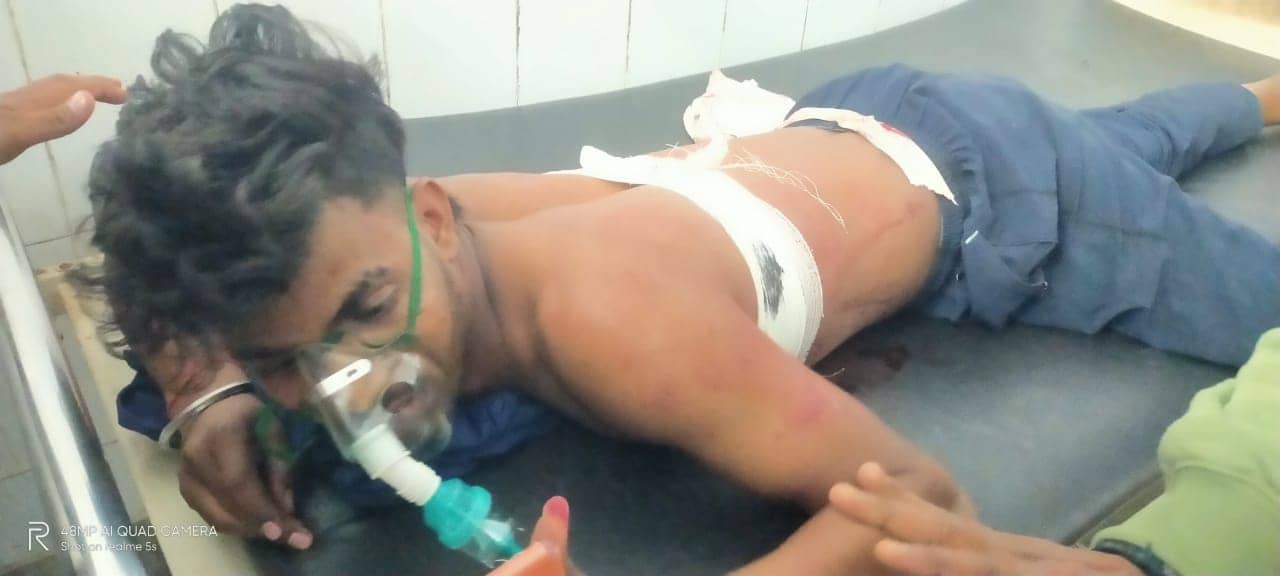BREAKING: हजारीबाग के बड़कागांव चौक पर दिनदहाड़े दो लोगों को चाकू मार कर किया घायल
