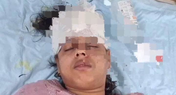 महिला से बीच सड़क चेन स्नैचिंग कर रहे थे बदमाश, लेकिन किसी ने नहीं की मदद, छीना झपटी में हुआ ये हाल 