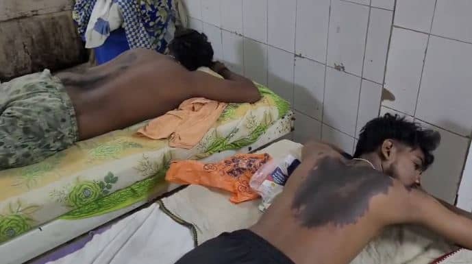 बड़ी खबर: जाति पर उठाया सवाल तो बीच सड़क पर दौड़ा-दौड़ा कर तेजाब से नहलाया, दहल उठा इलाका