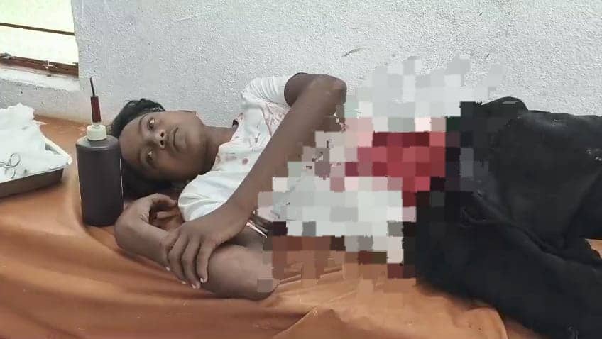 देवघर: आपसी रंजिश में युवक को मारा चाकू, गंभीर हालत में सदर अस्पताल में इलाजरत