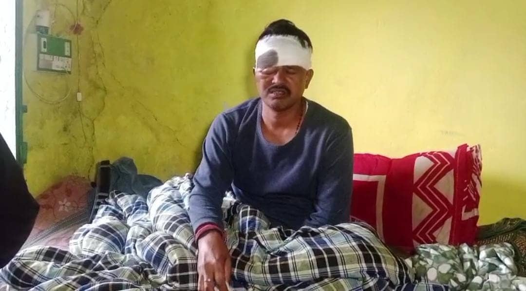 डूमरकुंडा उत्तर पंचायत के मुखिया पर जानलेवा हमला, नकाबपोश केबल चोरों ने पिस्टल के बट से किया घायल