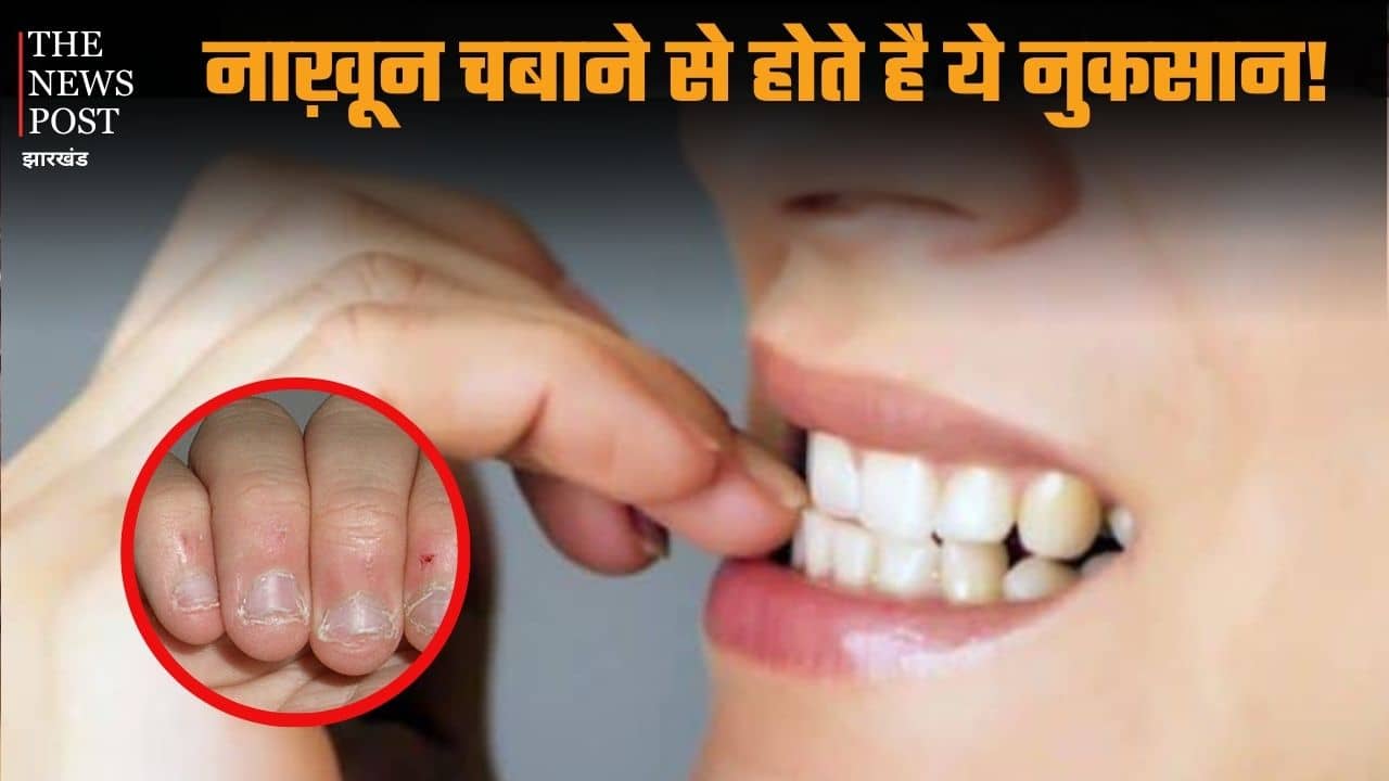 हर वक़्त चबाते रहते हैं उंगलियों के नाखून तो आज ही छोड़े ये बुरी आदत, वरना इन बीमारियों के हो जायेंगे शिकार