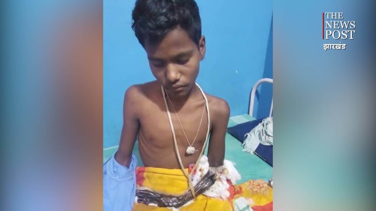 झोलाछाप वैद्य के इलाज ने बच्चे को बनाया दिव्यांग, दर्द से बिलबिलाते बच्चे को डॉक्टर ने दी राहत