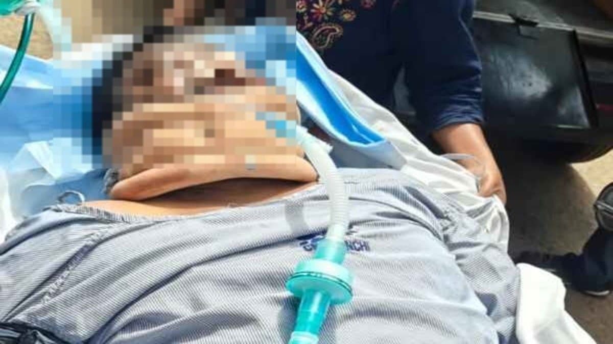 JMM नेता सुजीत कुजूर छत से गिरे, हालत गंभीर! ICU में भर्ती