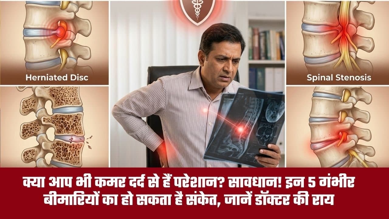 अगर आप भी कमर दर्द से हैं परेशान, तो हो जाए सावधान! इन 5 गंभीर बीमारियों का हो सकता है संकेत, जानें डॉक्टर की राय