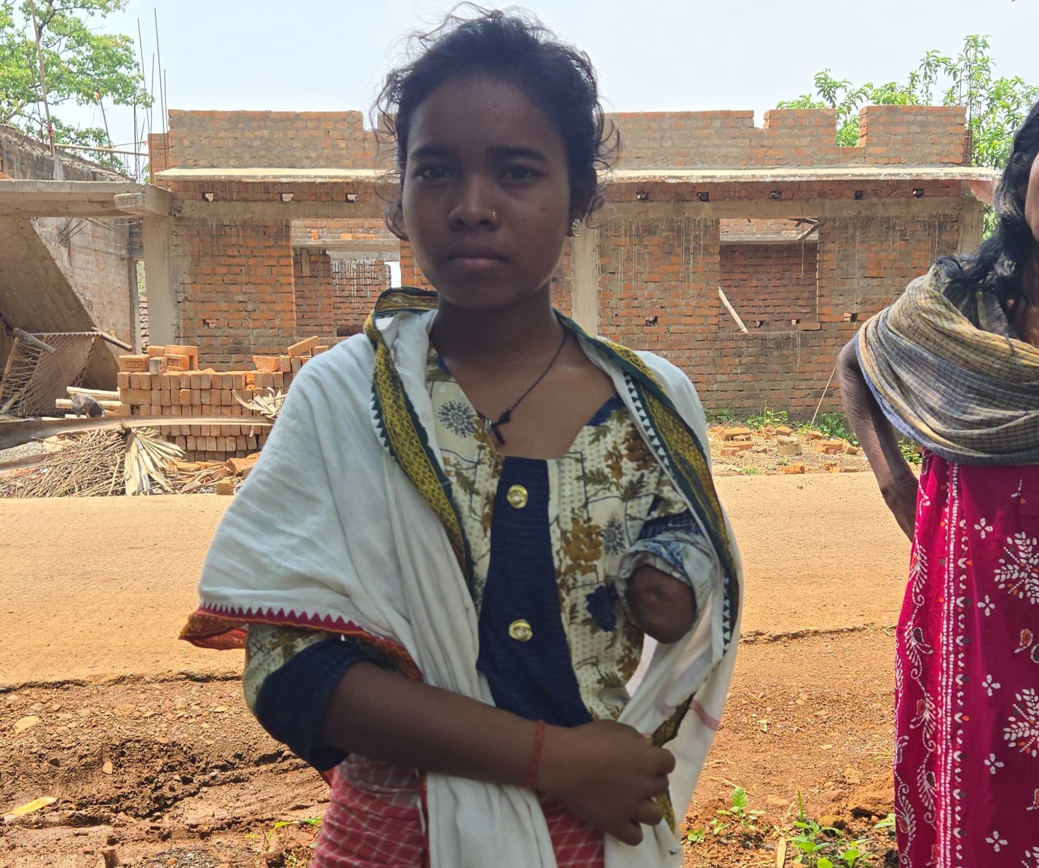 कंपनी में काम करने के दौरान क्रेसर से कटा हाथ, ना मुआवज़ा मिली, ना नौकरी, ना न्याय, पाकुड़ की बेबस पकू टुडू की कहानी जान हैरान हो जाएंगे आप