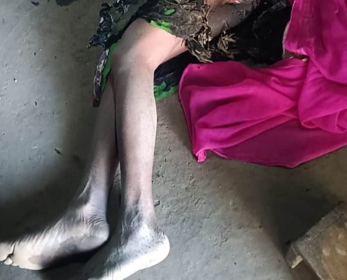 Big Breaking: दुमका में आदिम जनजाति की दो महिलाओं की जिंदा जलकर मौत, मामला संदेहास्पद !