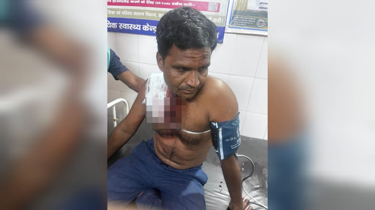 दुमका में आपसी विवाद ने लिया खूनी मोड़, बकरी व्यापारी के सीने में मारी गोली, हालत गंभीर