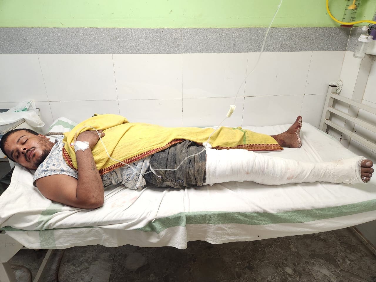 बंटी यादव हत्याकांड का मुख्य आरोपी पुलिस एनकाउंटर में घायल, अस्पताल में भर्ती