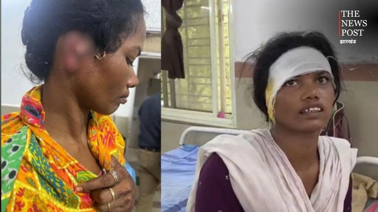 ऐसे कौन करता है जी ! देवरानी-जेठानी के बीच हुआ विवाद तो देवरानी ने दांतों से काट लिया कान, फिर जो हुआ.....