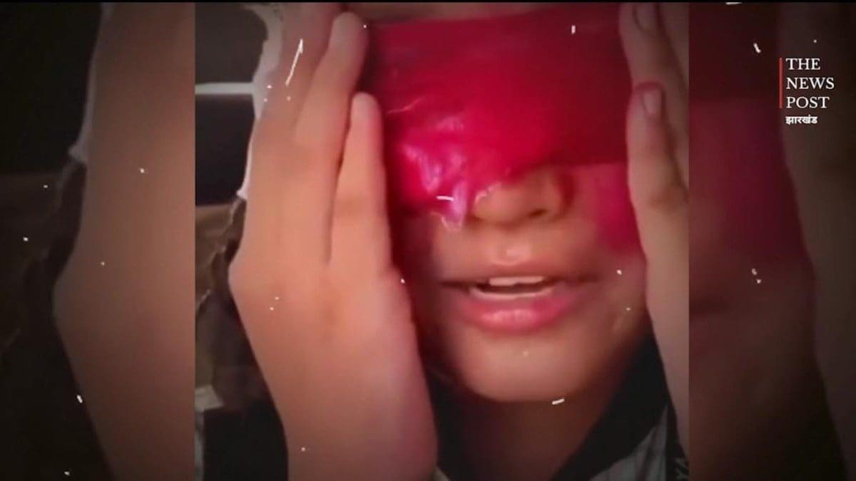 डॉक्टर ने निकाल ली बच्चे की आंख...! मोबाइल छुड़ाने के लिए किया ऐसा हाल, वीडियो देख दहल जाएगा कलेजा
