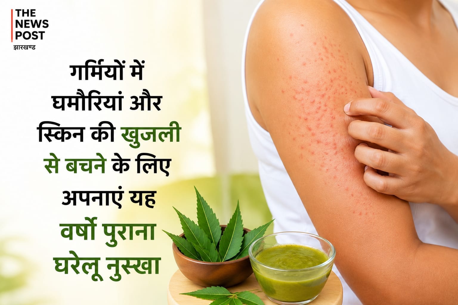 गर्मियों में घमौरियां और स्किन की खुजली से बचने के लिए अपनाएं यह वर्षों पुराना घरेलू नुस्खा