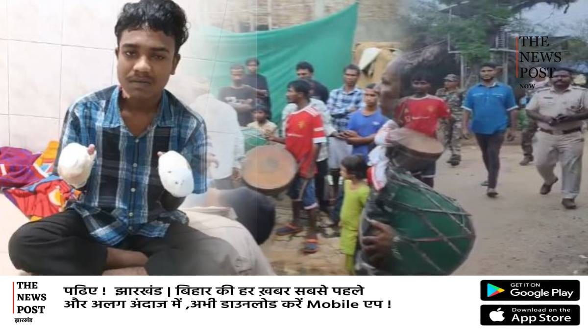 पहले चोरी का लगाया आरोप फिर सच्चाई की परीक्षा के नाम पर जला दिया हाथ,काटनी पड़ गई 10 उंगली   