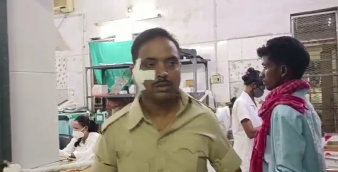 MGM अस्प्ताल में विक्षिप्त का हंगामा, पत्थर मार एबुलेंस का शीशा तोड़ा , जवान का सिर फोड़ा