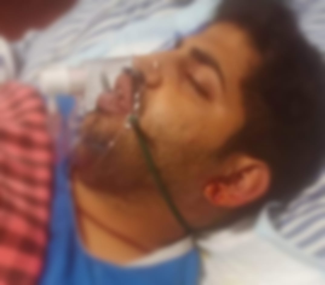 सिंदरी बवाल में घायल दरोगा की हालत में सुधार, शरीर में हुई हरकत, लोगों ने की थाना परिसर में खास पूजा- अर्चना