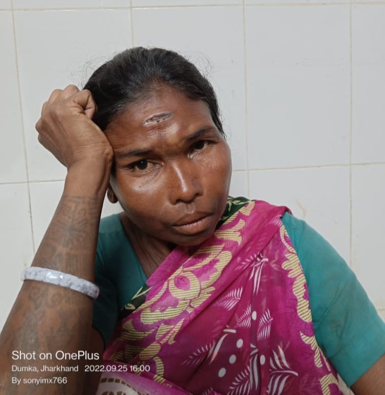 शर्मनाक : दुमका के सरैया हाट में जिस तरह से घटना घटी , सरकार और सभ्य समाज के मुंह पर तमाचा है