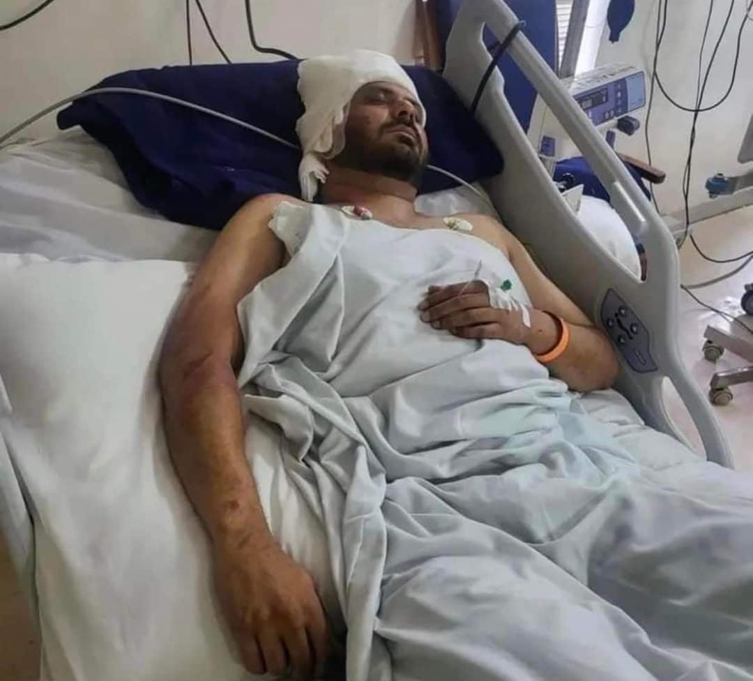 Yo Yo Honey Singh के साथ 14 गानों में काम कर चुके सिंगर अल्फाज पर जानलेवा हमला, हालत नाजुक