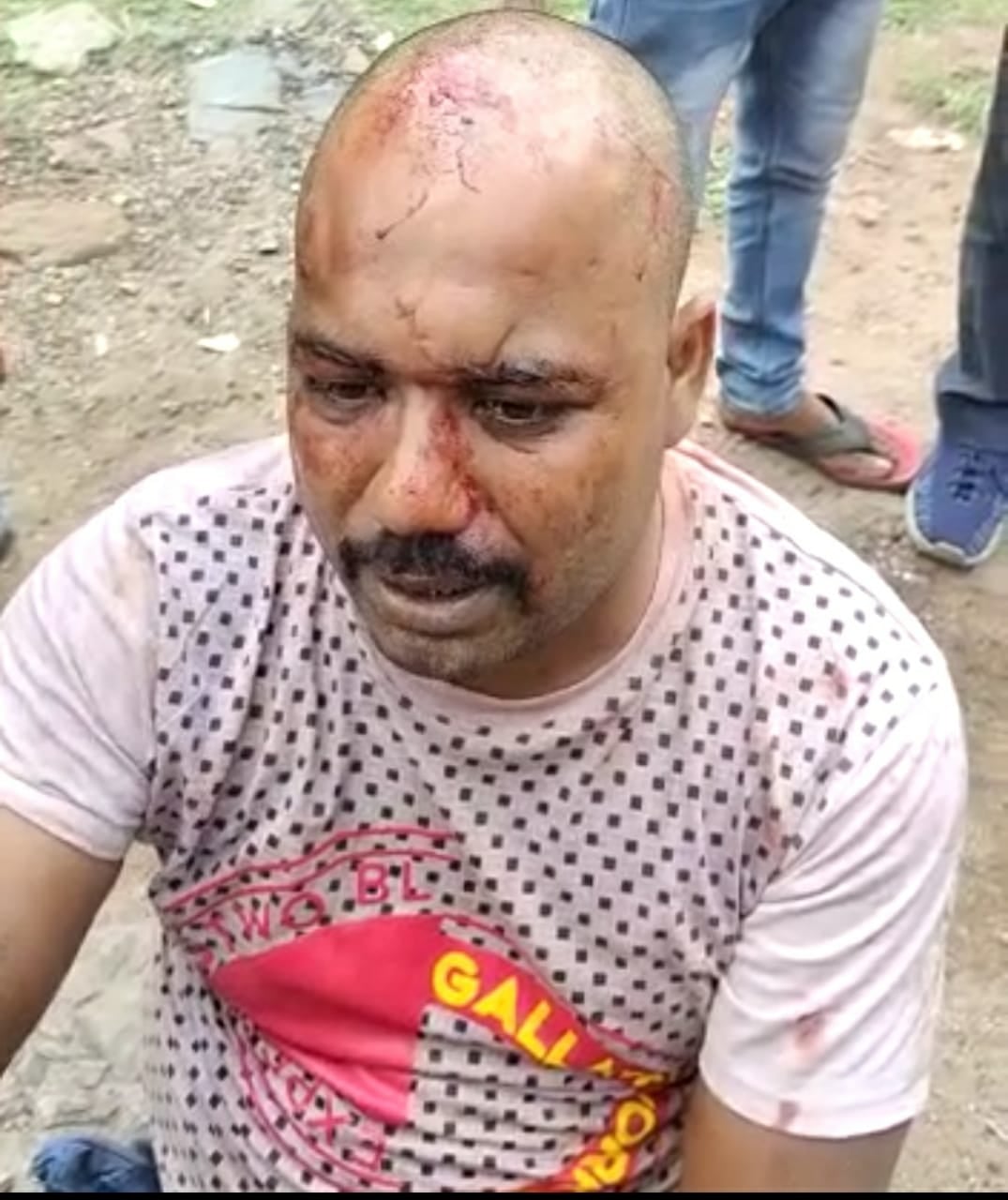 फिर हुई फायरिंग, फिर लगी गोली, जानिए कहां का है मामला