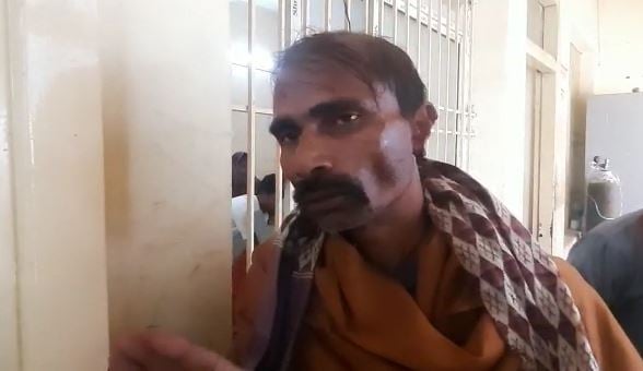 नाक की लड़ाई में कान कटा बैठे चाचा, कटा कान लेकर भतीजा हुआ फरार, जानिए क्या है मामला