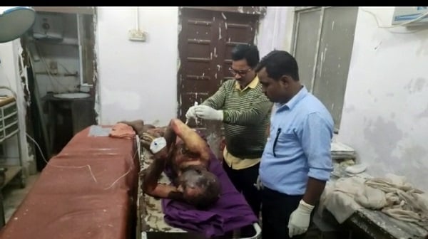 पत्नी के छोड़ कर जाने से नाराज व्यक्ति  ने खुद को लगाई आग, जानिए पूरी खबर