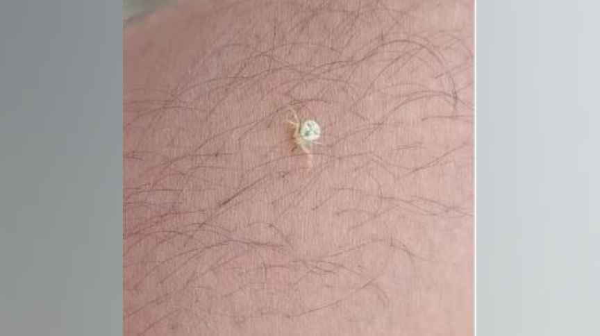 जमशेदपुर में मौजूद सबसे बड़े वन क्षेत्र दलमा के जंगलों में मिली मानवीय शक्ल की मकड़ी, लोगों ने बताया दूसरे ग्रह का