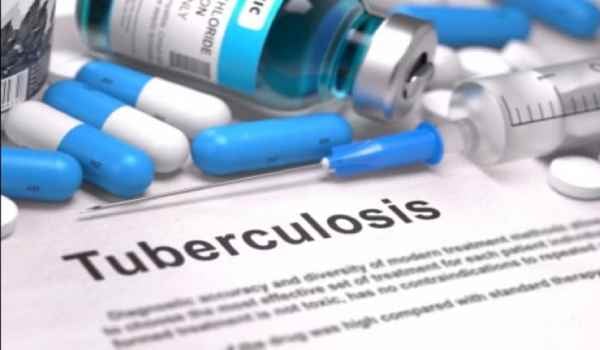 क्या झारखंड में टीबी की दवा में भी हो गया खेला! सामने आ सकता है एक और भ्रष्टाचार का मामला