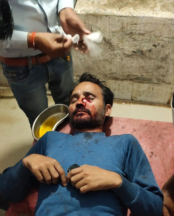 गोड्डा के पथरगामा थाना क्षेत्र में  50 रुपया रंगदारी नहीं देने पर अपराधी ने चलाई गोली