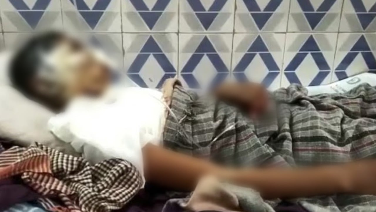 गुजरात के स्कूल में बच्चे से जानवरों जैसा सलूक, बगीचे की सफाई से मना करने पर स्कूल संचालकों ने लगाया इलेक्ट्रिक शॉक