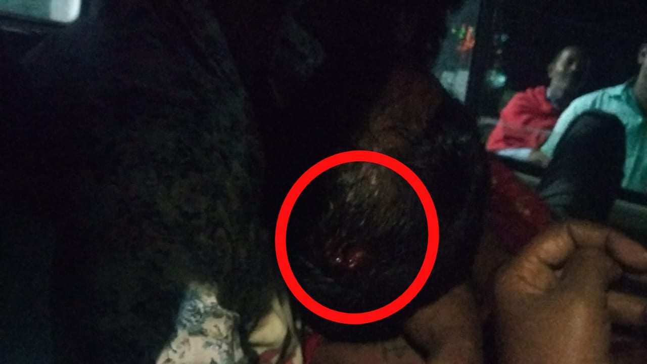 अवैध बालू उठाव के वर्चस्व को लेकर चली गोली, दो घायल