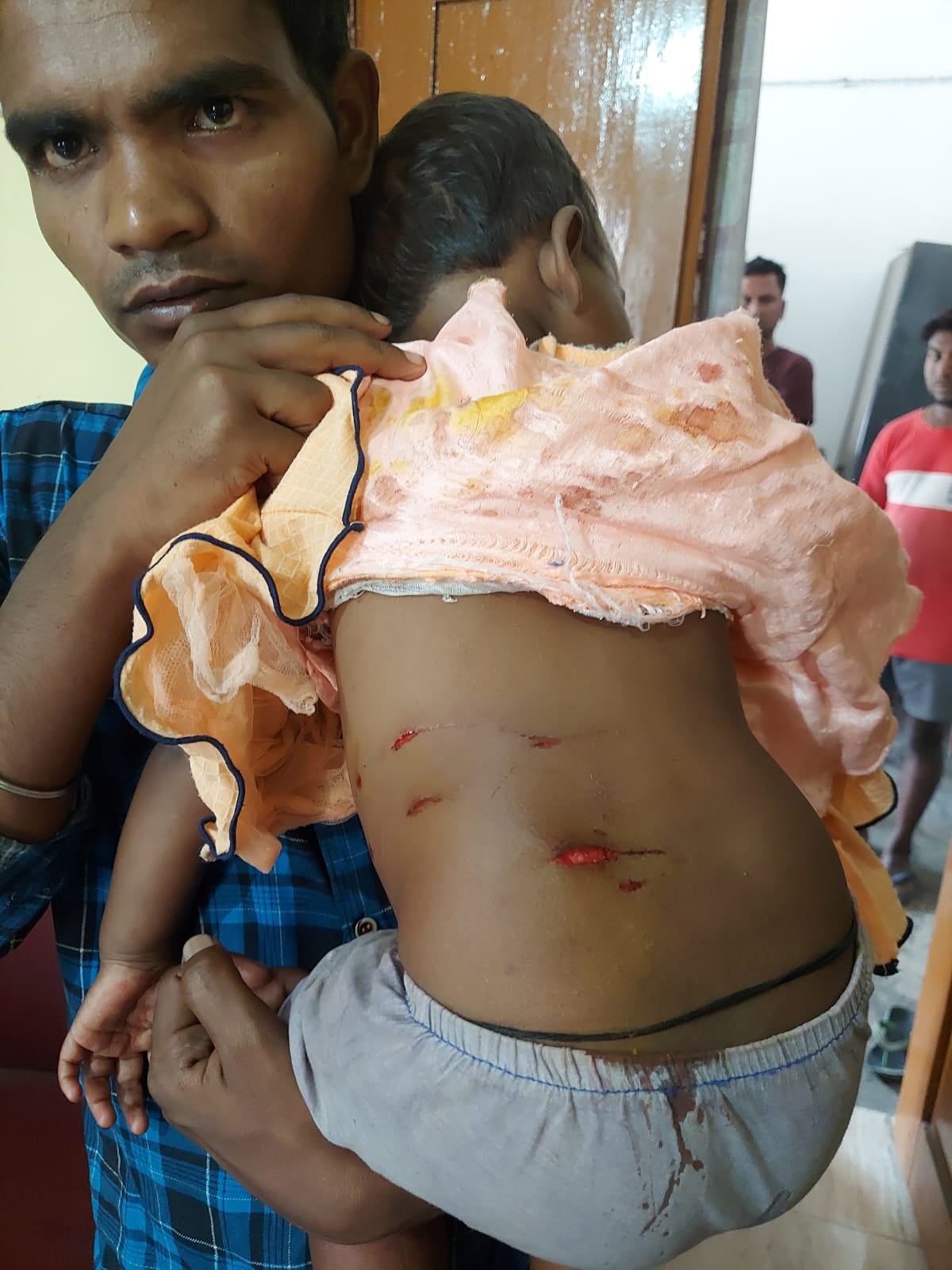 कोयलांचल के लोग माफियाओं के बाद अब कुत्तों से लड़ रहे, देखिए पूरी खबर