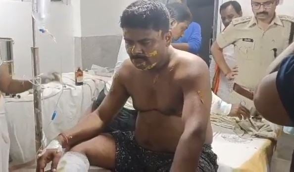 बेगूसराय में बखरी CO शिवेद्र कुमार पर जानलेवा हमला, घर में घुसकर किया वार
