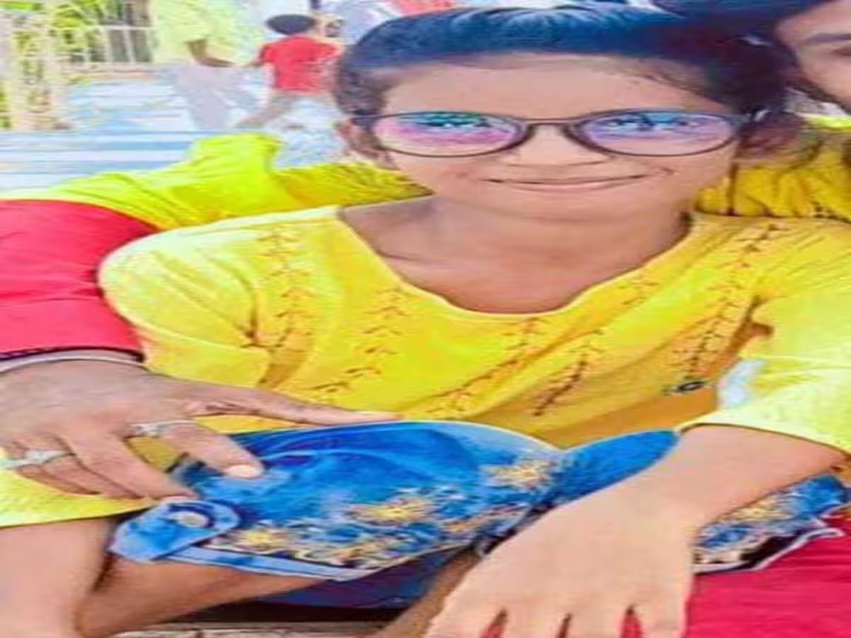 झरिया की आग हुई भयावह -गर्म ओ बी से झुलसी बच्ची हार गई जीवन की लड़ाई ,बुआ की हालत गंभीर